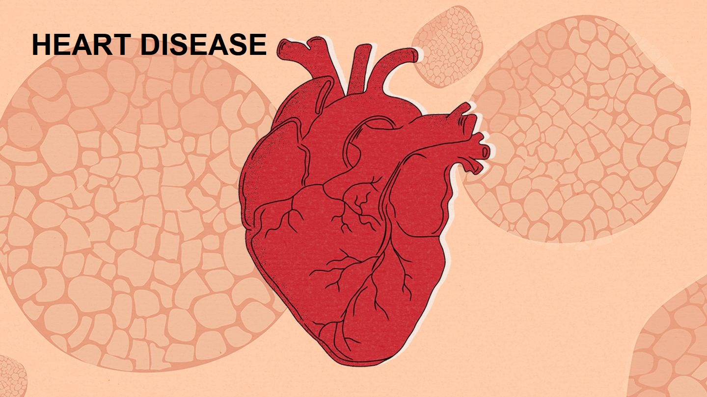 Heart disease